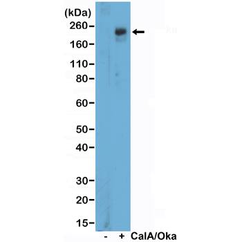 ULK1 Antibody (RM488)