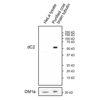 alpha Tubulin Antibody (RM447)