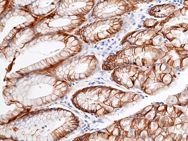 Carbonic Anhydrase IX/CA9 Antibody (RM486)