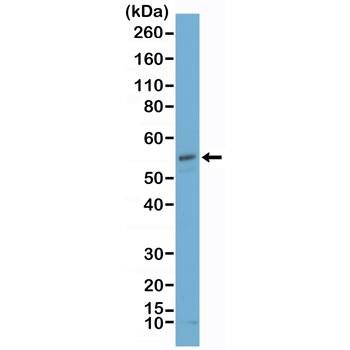 Carbonic Anhydrase IX/CA9 Antibody (RM486)