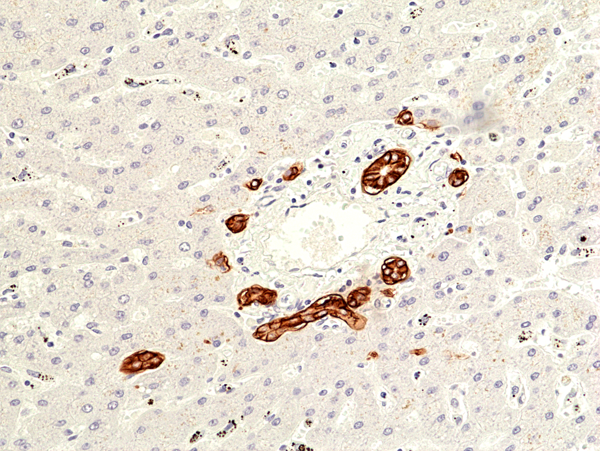 Carbonic Anhydrase IX/CA9 Antibody (RM486)