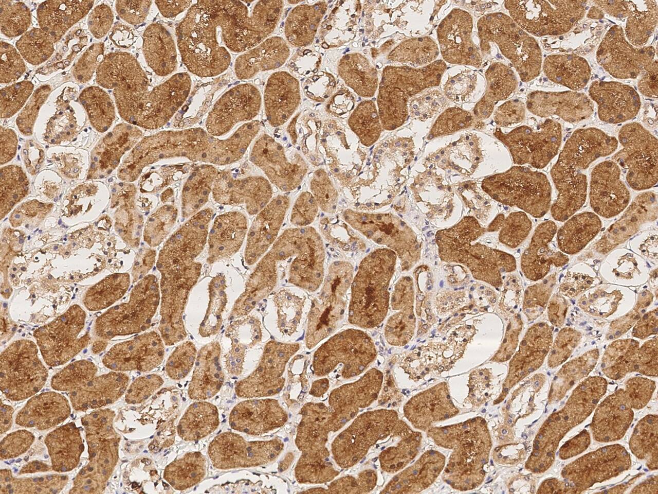 L3HYPDH Antibody