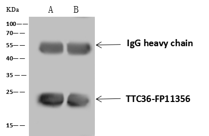 TTC36 Antibody - BSA Free