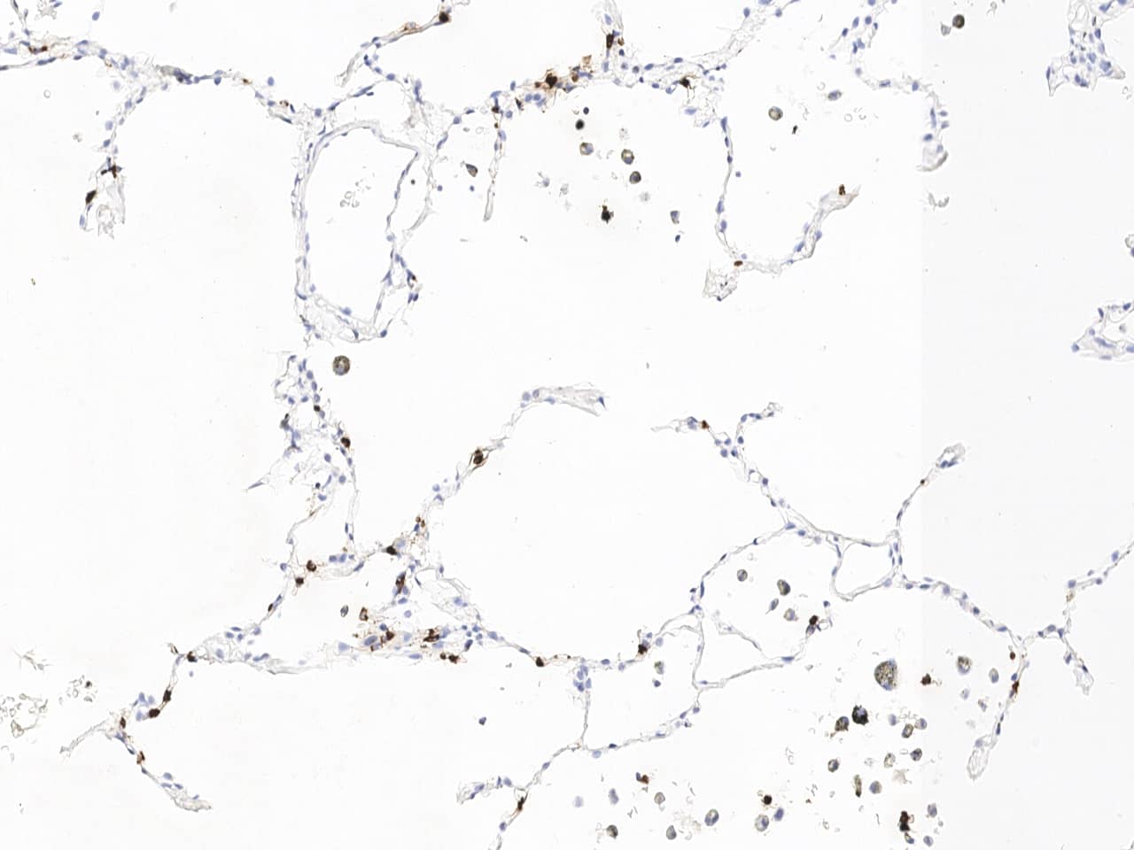 Lipocalin-2/NGAL Antibody (508)