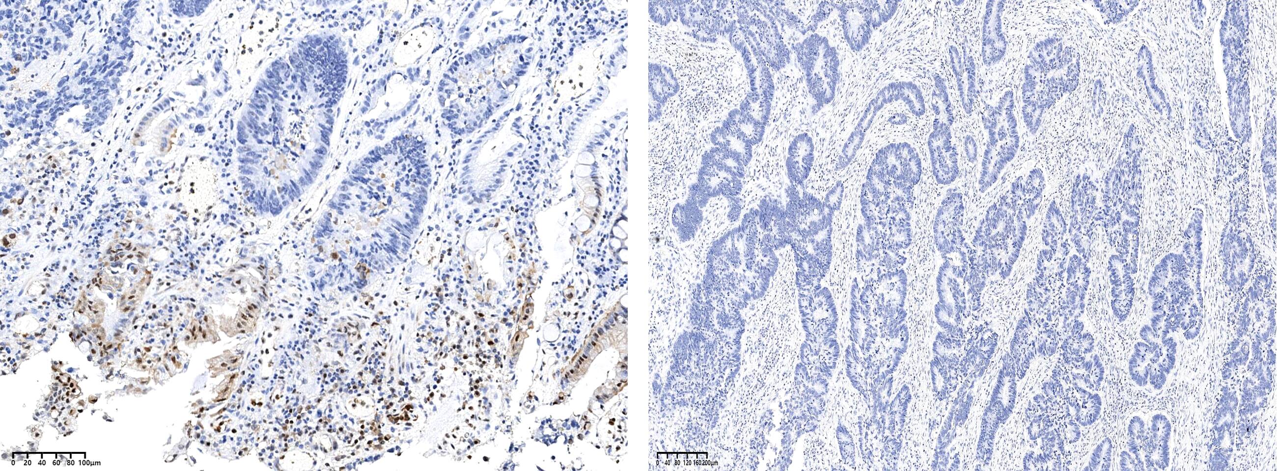 p38 alpha Antibody (0004) - Azide and BSA Free