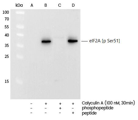 eIF2A Antibody (0011)