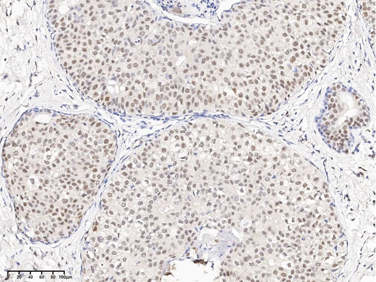 ERK1/ERK2 [p Thr202, p Tyr204] Antibody - Azide and BSA Free