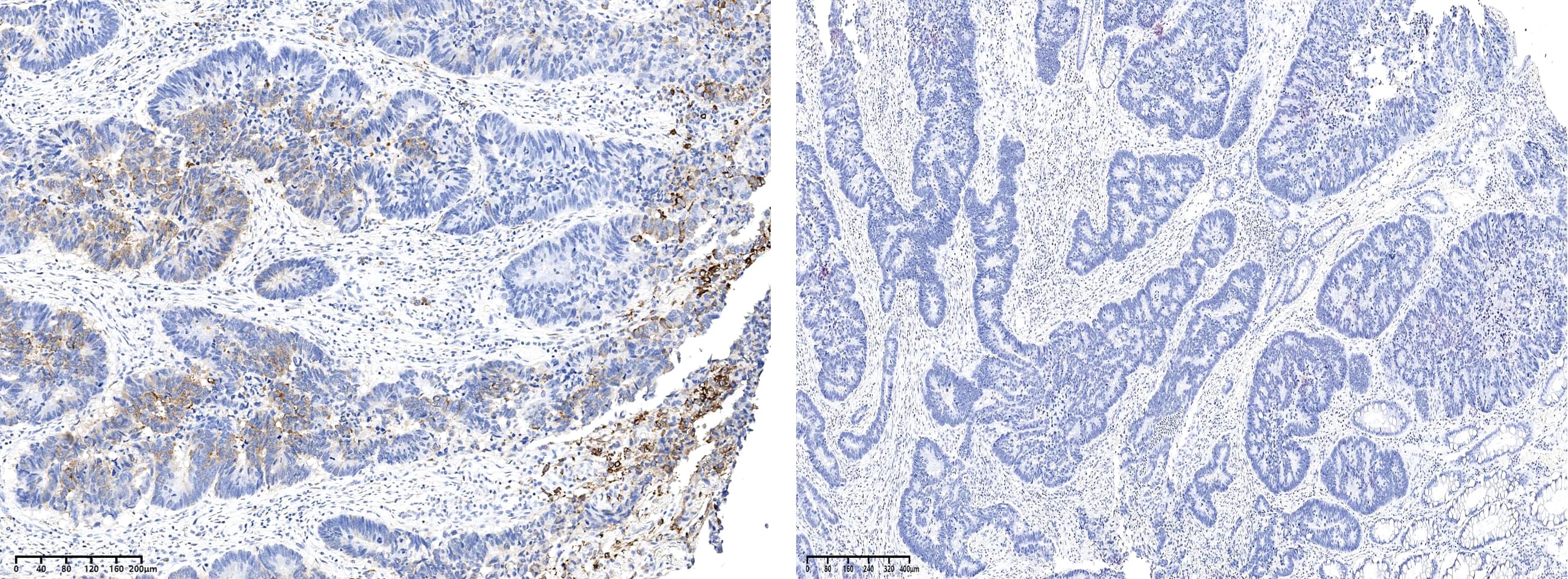 Ribosomal Protein S6/RPS6 [p Ser240, p Ser244] Antibody (0018) - Azide and BSA Free