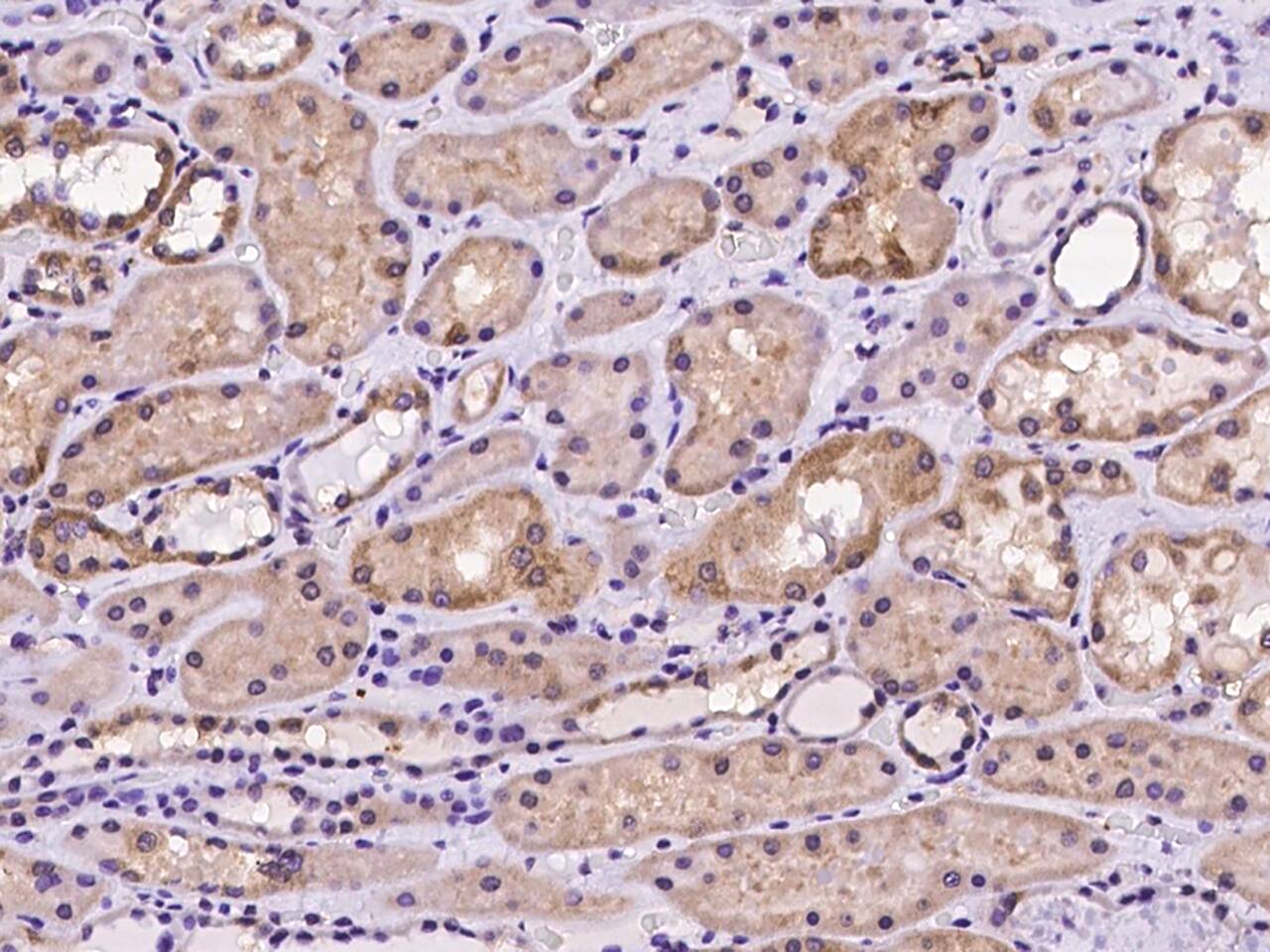 dynactin 4 Antibody - Azide and BSA Free