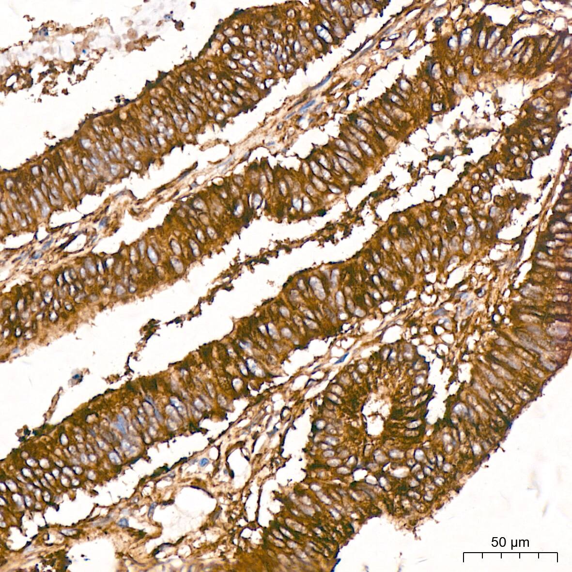 Tubulin alpha-1B Antibody (ARC51243)