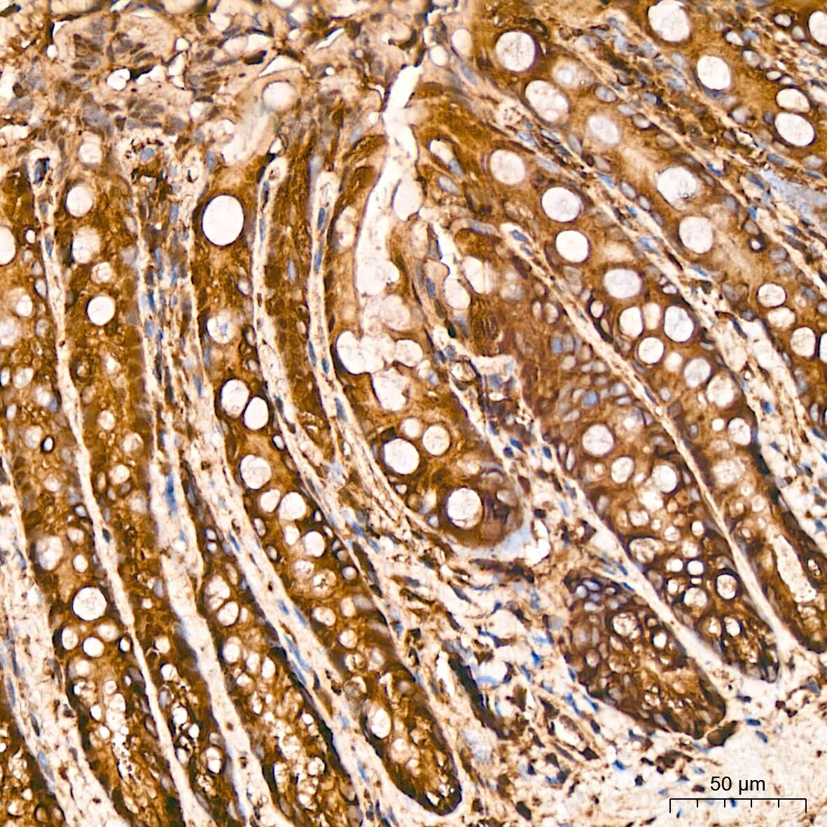 Tubulin alpha-1B Antibody (ARC51243)