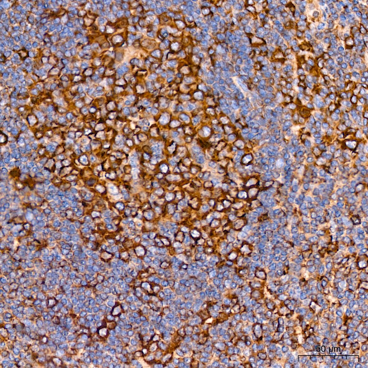 Tubulin alpha-1B Antibody (ARC51243)