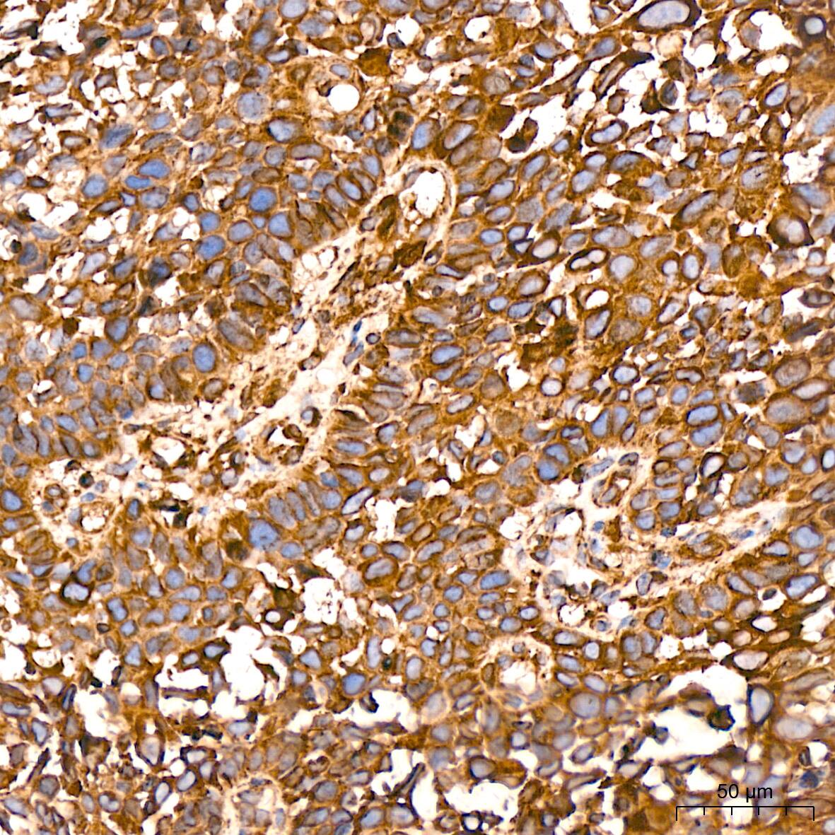 Tubulin alpha-1B Antibody (ARC51243)