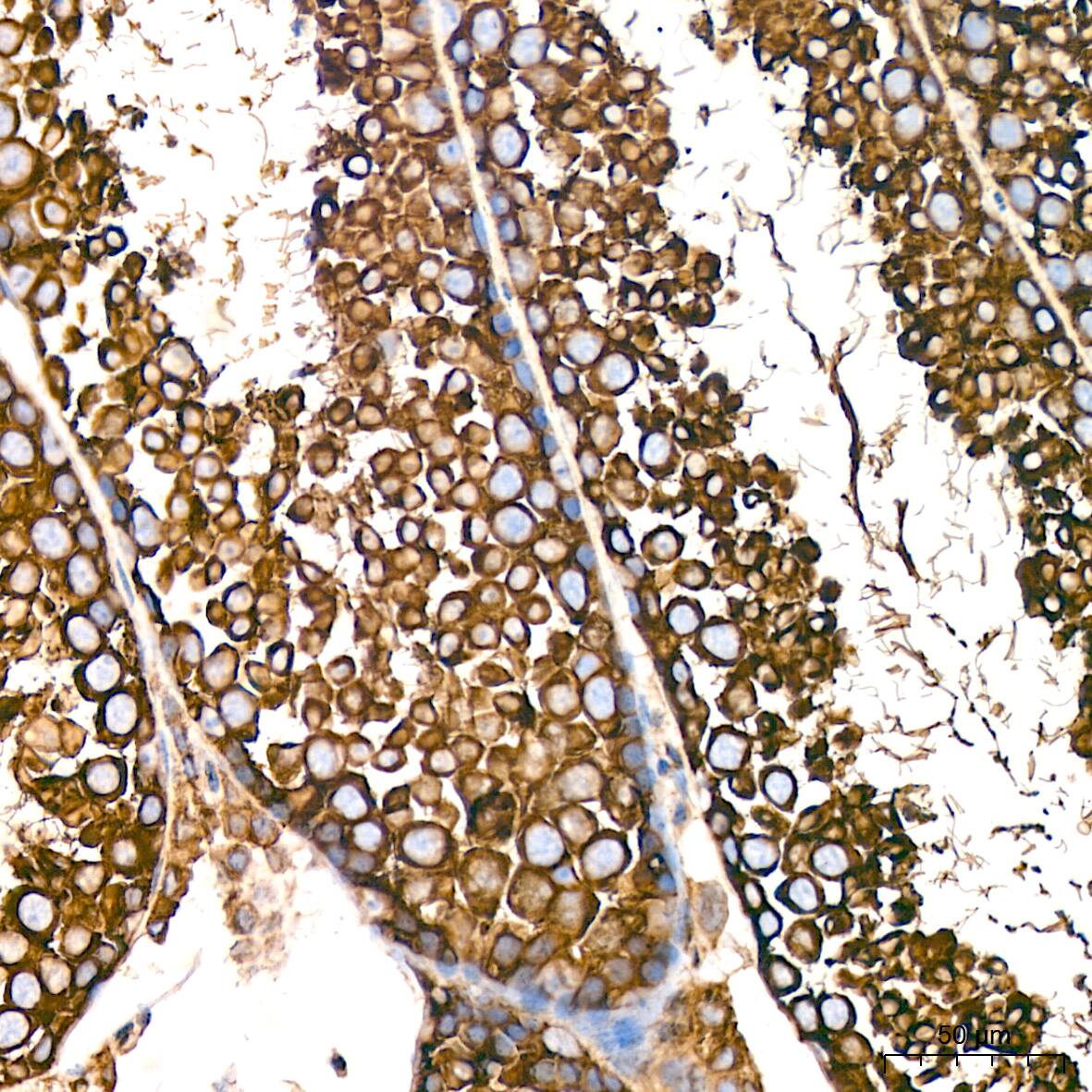 Tubulin alpha-1B Antibody (ARC51243)