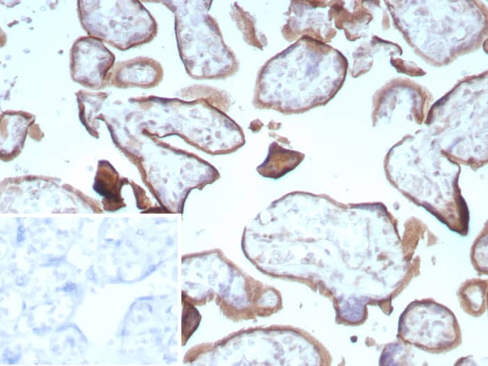 Endoglin/CD105 Antibody (ENG/8961R)