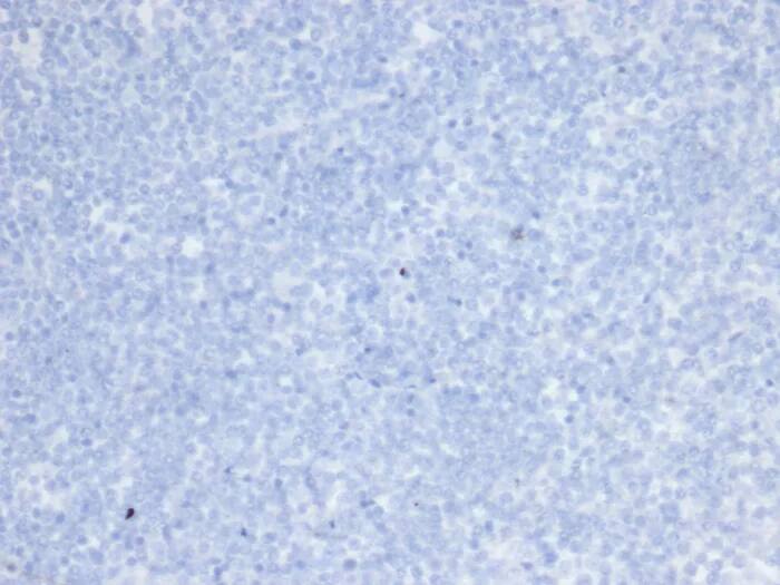 ErbB2/Her2 Antibody (rERBB2/6637) Immunohistochemistry-Paraffin: ErbB2/Her2 Antibody (rERBB2/6637) [NBP3-23581] -