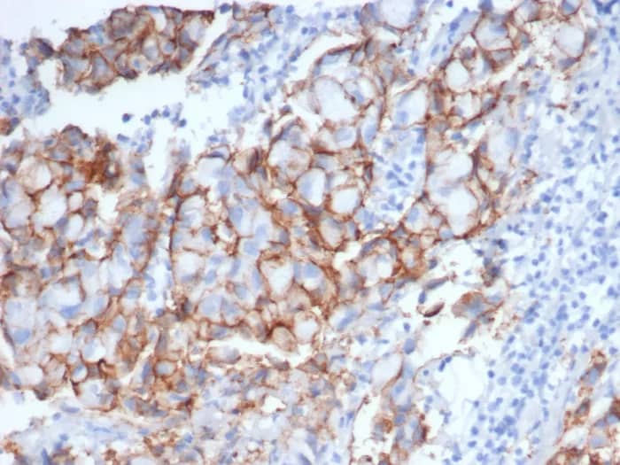 ErbB2/Her2 Antibody (rERBB2/6637) Immunohistochemistry-Paraffin: ErbB2/Her2 Antibody (rERBB2/6637) [NBP3-23581] -