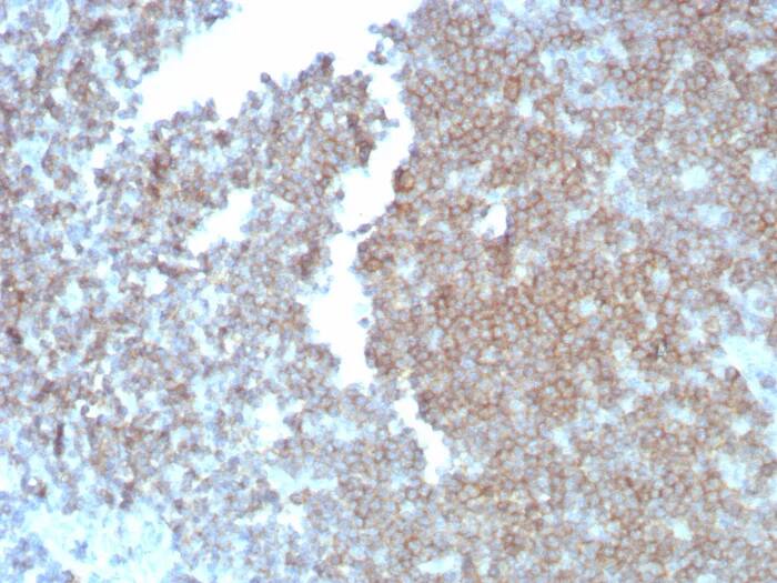 CD27/TNFRSF7 Antibody (LPFS2/8838R) Immunohistochemistry-Paraffin: CD27/TNFRSF7 Antibody (LPFS2/8838R) [NBP3-23582] -