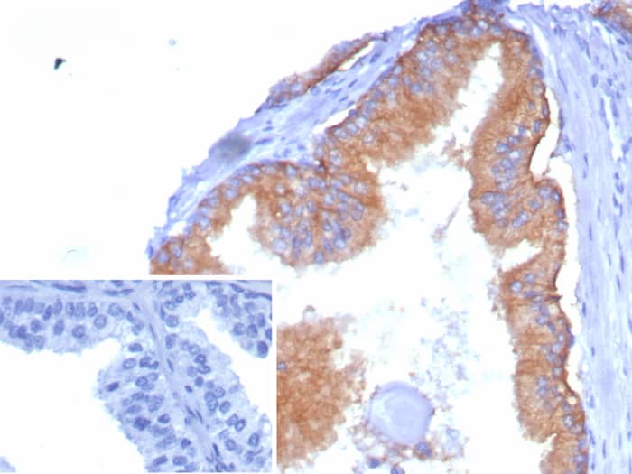 CD38 Antibody (rCD38/8334)