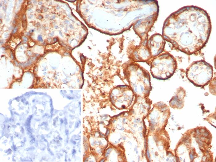 HEXB Antibody (HEXB/7762)