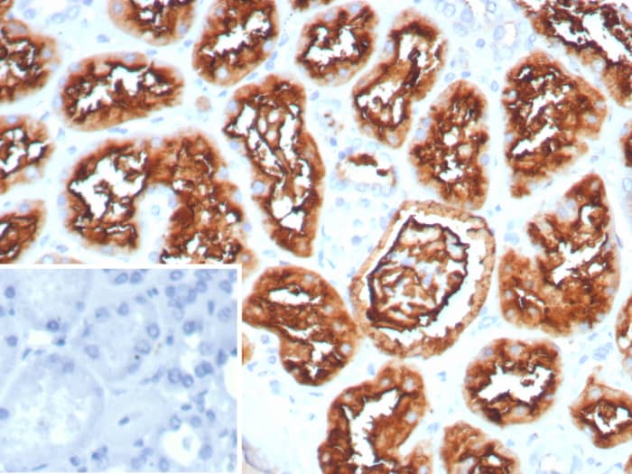 Neprilysin/CD10 Antibody (MME/8281R)