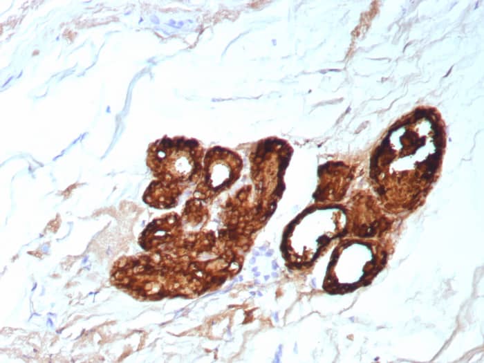 PIP Antibody (PIP/9076R)