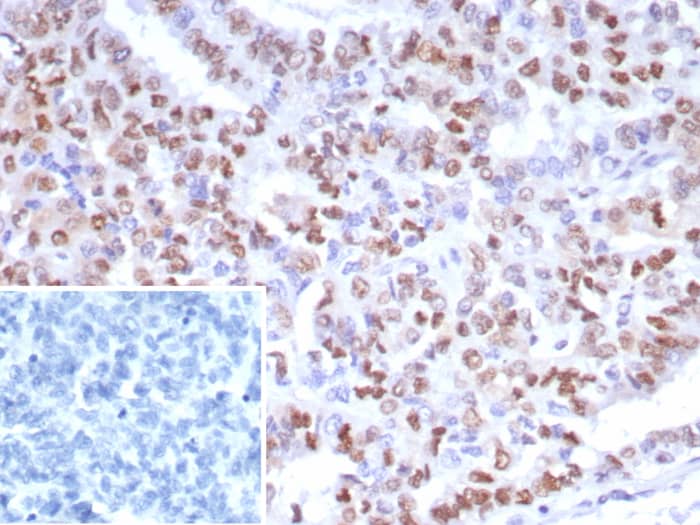 PMS2 Antibody (PMS2/8224R)