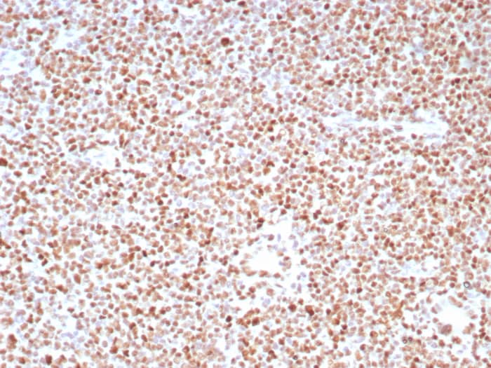 PMS2 Antibody (PMS2/8224R)