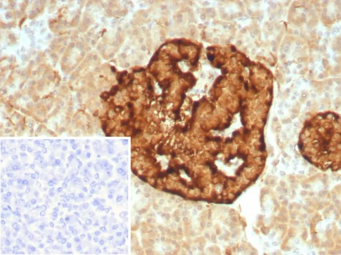 Chromogranin A Antibody (CHGA/8929R) Immunohistochemistry-Paraffin: Chromogranin A Antibody (CHGA/8929R) [NBP3-23592] -