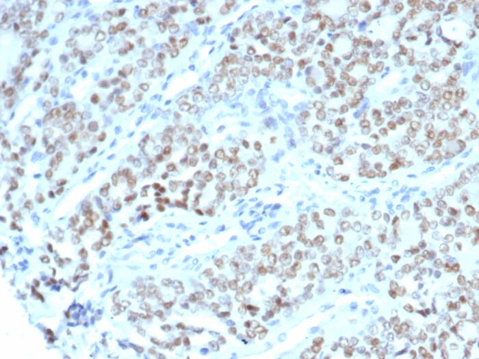 BTBD9 Antibody (BTBD9/7501)