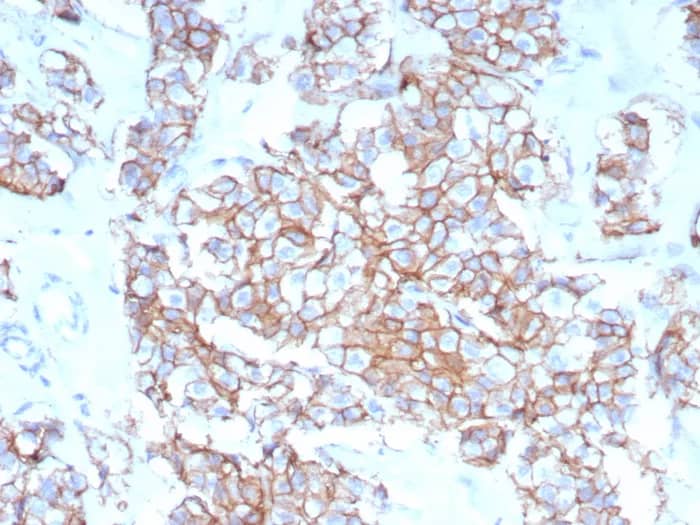 ErbB2/Her2 Antibody (rERBB2/9401) Immunohistochemistry-Paraffin: ErbB2/Her2 Antibody (rERBB2/9401) [NBP3-23594] -