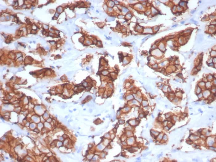 ErbB2/Her2 Antibody (ERBB2/7158R) Immunohistochemistry-Paraffin: ErbB2/Her2 Antibody (ERBB2/7158R) [NBP3-23595] -