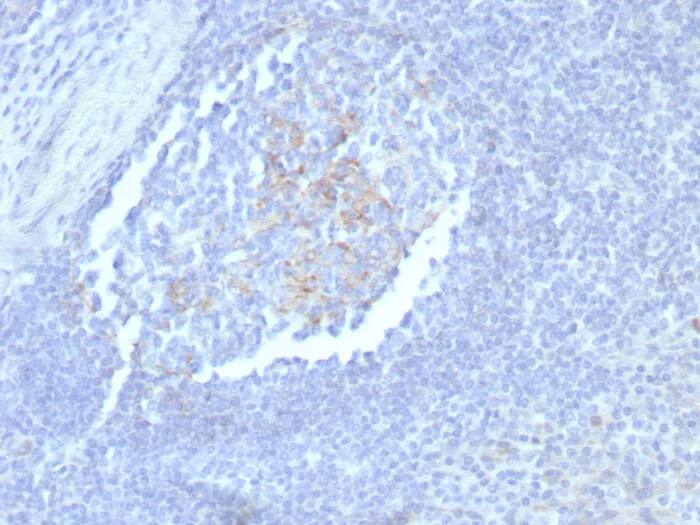 CD23/Fc epsilon RII Antibody (FCER2/8235R) Immunohistochemistry-Paraffin: CD23/Fc epsilon RII Antibody (FCER2/8235R) [NBP3-23604] -