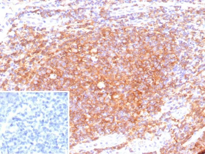 CD40/TNFRSF5 Antibody (C40/9225R) Immunohistochemistry-Paraffin: CD40/TNFRSF5 Antibody (C40/9225R) [NBP3-23606] -