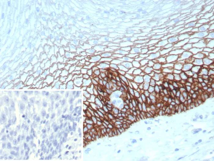 CD44 Antibody (CD44V6/9400R) Immunohistochemistry-Paraffin: CD44 Antibody (CD44V6/9400R) [NBP3-23607] -