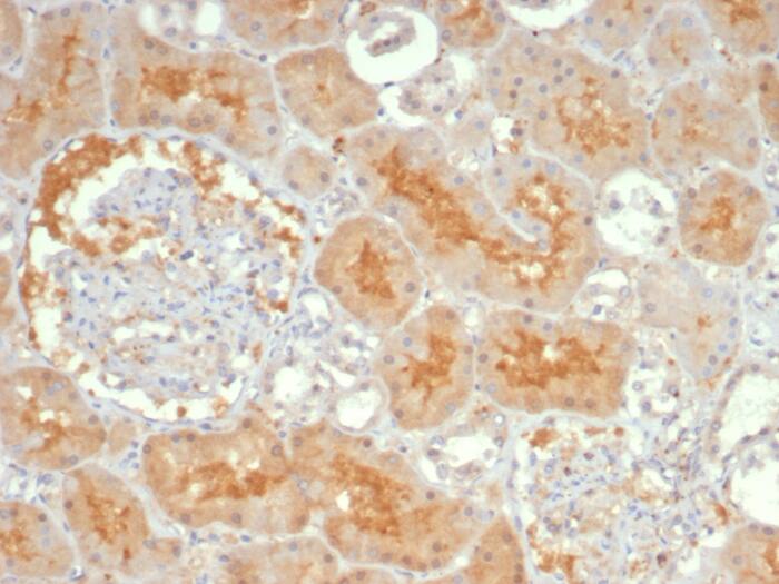 Adenylate Cyclase 8 Antibody (ADCY8/7341)