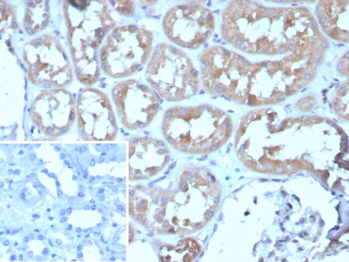 Adenylate Cyclase 8 Antibody (ADCY8/7573)