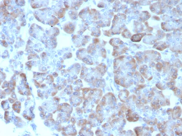 Adenylate Cyclase 8 Antibody (ADCY8/7573)