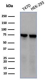 HspA1B Antibody (HSPA1B/7623)