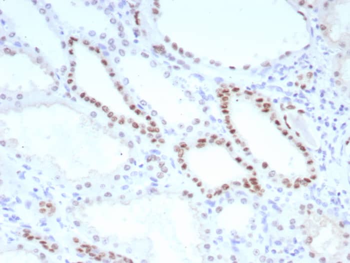 PAX8 Antibody (PAX8/8651R)