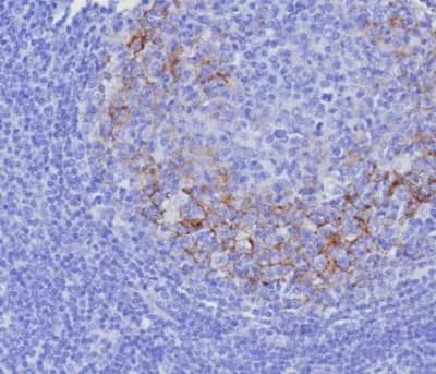 CD23/Fc epsilon RII Antibody (FCER2/8237R) Immunohistochemistry-Paraffin: CD23/Fc epsilon RII Antibody (FCER2/8237R) [NBP3-23614] -