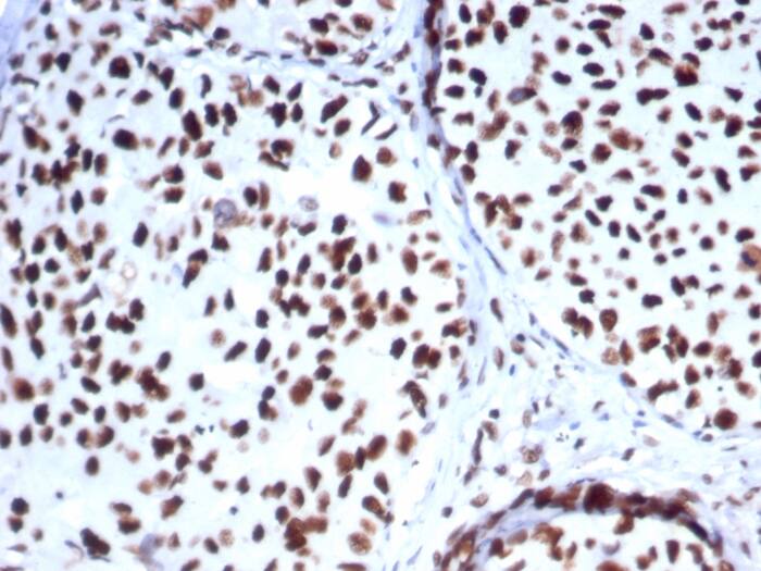 HspA1B Antibody (HSPA1B/7625)