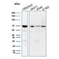 IMP3 Antibody (IMP3/8934R) Western Blot: IMP3 Antibody (IMP3/8934R) [NBP3-23624] -