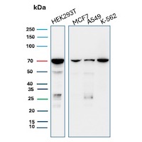 IMP3 Antibody (IMP3/8985R) Western Blot: IMP3 Antibody (IMP3/8985R) [NBP3-23625] -