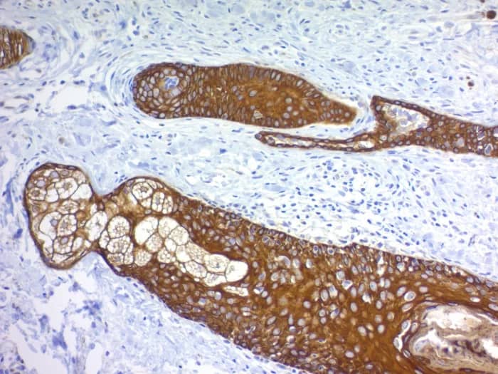 Cytokeratin, pan Antibody (MonoPoly/4999R) Immunohistochemistry-Paraffin: Cytokeratin, pan Antibody (MonoPoly/4999R) [NBP3-23627] -