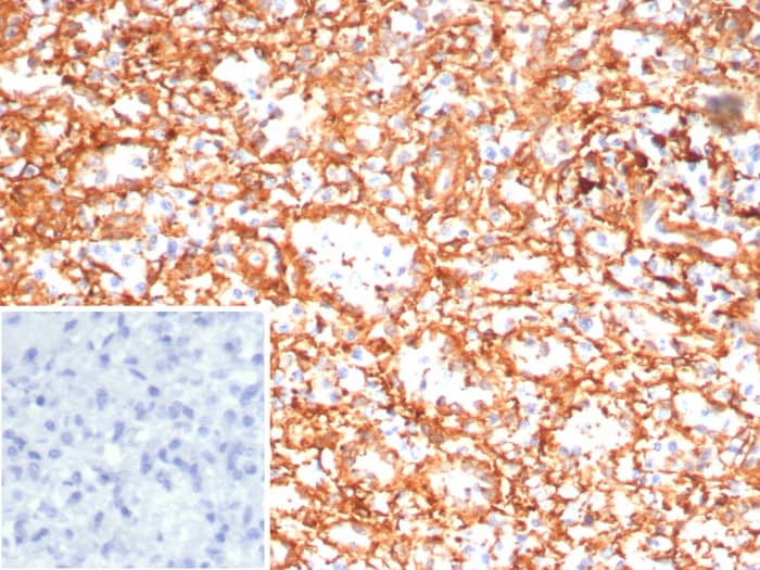 Adenylate Cyclase 8 Antibody (ADCY8/7574)