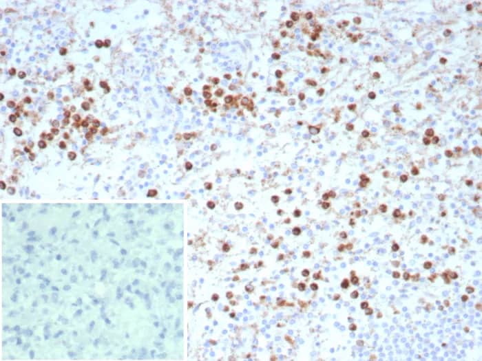 CD63 Antibody (rLAMP3/9131) Immunohistochemistry-Paraffin: CD63 Antibody (rLAMP3/9131) [NBP3-23630] -