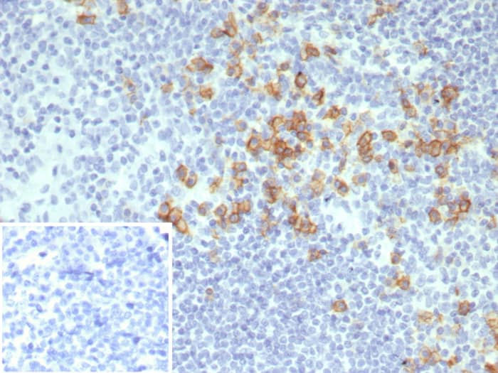 CD38 Antibody (CD38/8075R)