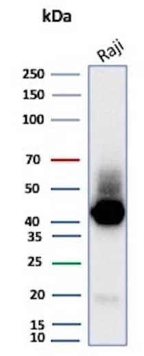 CD38 Antibody (CD38/8075R) Western Blot: CD38 Antibody (CD38/8075R) [NBP3-23631] -
