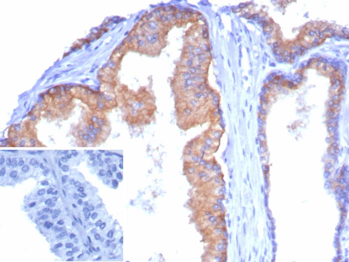 CD38 Antibody (CD38/8335R)